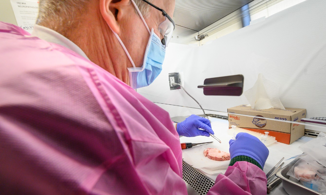 Image of a scientist studying a brain